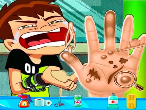 Ben10 Hand Doctor - Free Online Game - free online Browser game