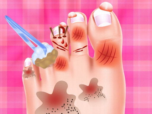 Baby Taylor Foot Treatment - free online Browser game